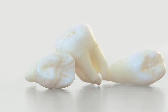 white extracted teeth