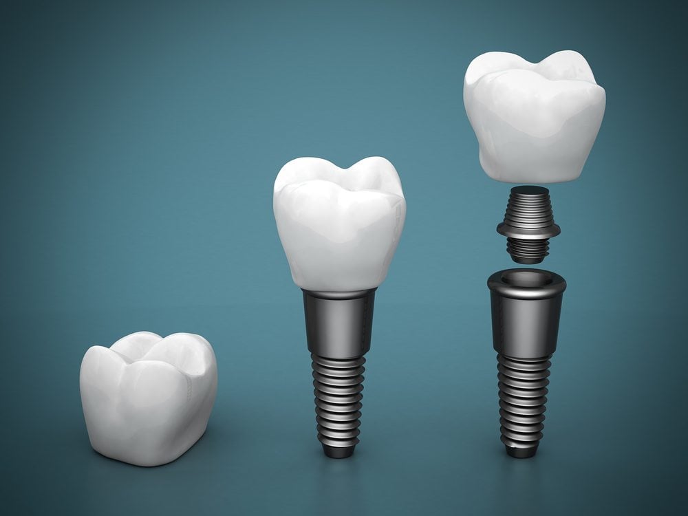 dental surgery Southlake